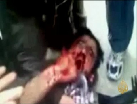 مأساة جرحى الثورة السورية