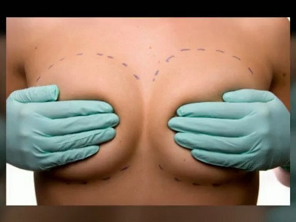 Alabama Plastic Surgeon | Tuscaloosa, Fayette, Birmingham