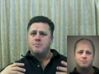 Non Surgical Hair Replacement - Having Hair Makes All The Difference