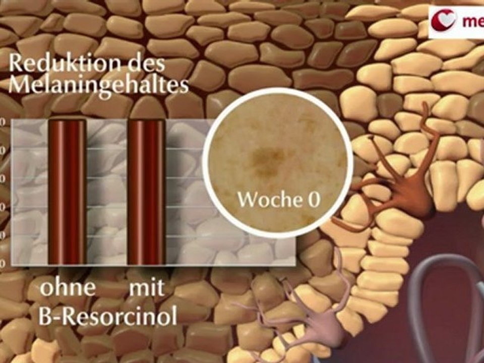 Pflege gegen pigmentflecken: eucerin even brighter