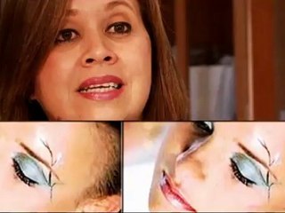 Saber Vivir: Rellenos Faciales