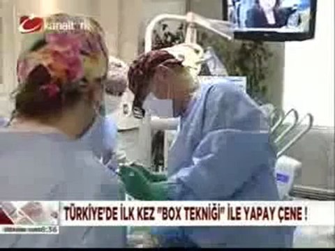 Türkiye'de İlk Kez Box Teknik İle Yapay Çene!