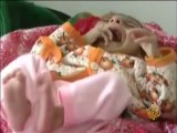 اليونسيف تدعو لتقديم مساعدات عاجلة لأطفال اليمن
