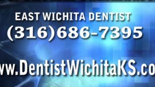Cosmetic Dentist Wichita KS, Dental Veneer vs. Lumineer, Procelain Veneers 67206, Dentist Mcconnell, Dr. Fankhauser