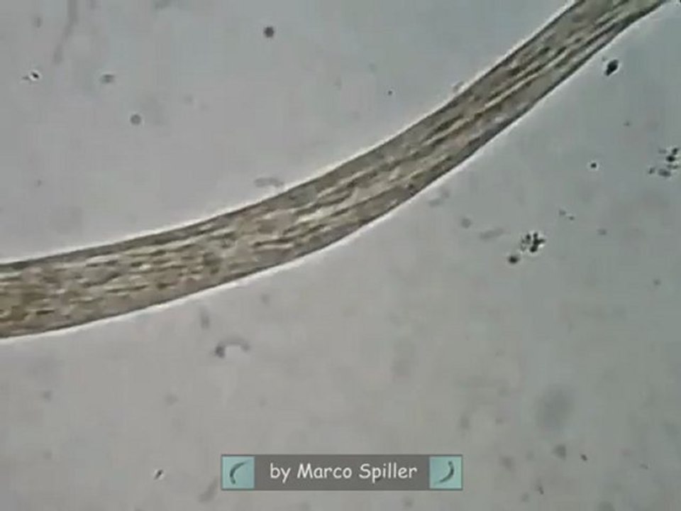 Spirostomum in action