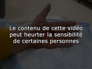 Cloque énorme à la main