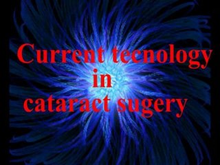 cataract surgery animate -_complimentary from rushabh eye hospital_india_
