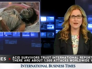 Disfigured Acid Attack Victim Pleads for Mercy Killing