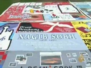 مريض الإيدز معرض للإصابة بأعراض الشيخوخة المبكرة