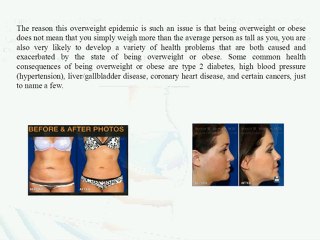 How to immediately eliminate that pesky, unwanted extra weight you’ve been carrying around