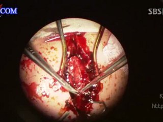 Surgeon.Bong.Dal.Hee.T04(00h32m50s-01h05m40s)