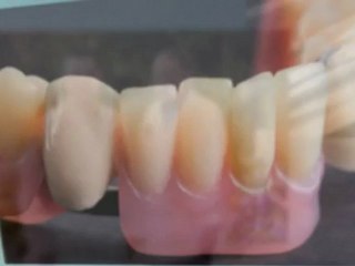 Information On Periodontal Therapy In San Antonio