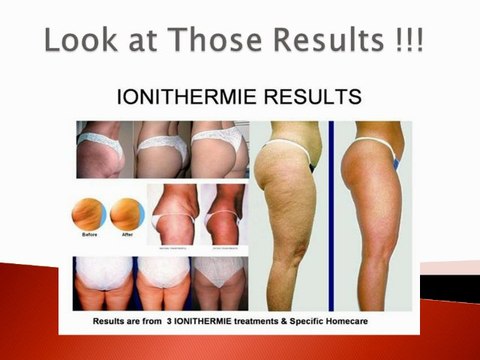 Ionithermie Products | Ionithermie Homecare Kits