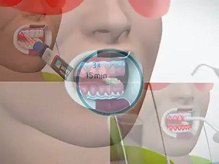 'dişevi' diş beyazlatma