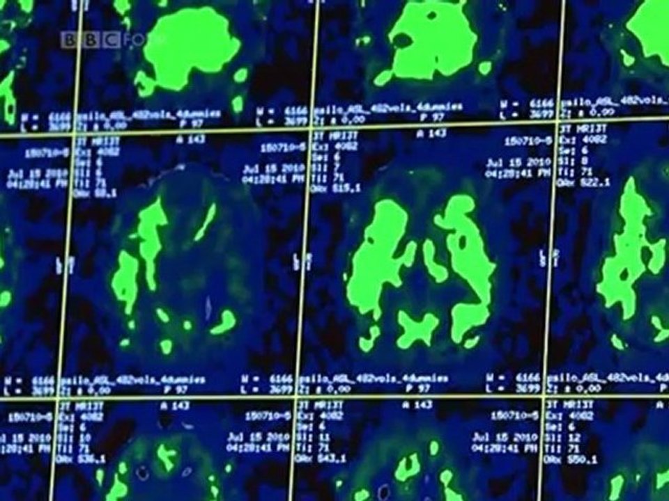 O Cérebro, uma História Secreta - Controle da Mente
