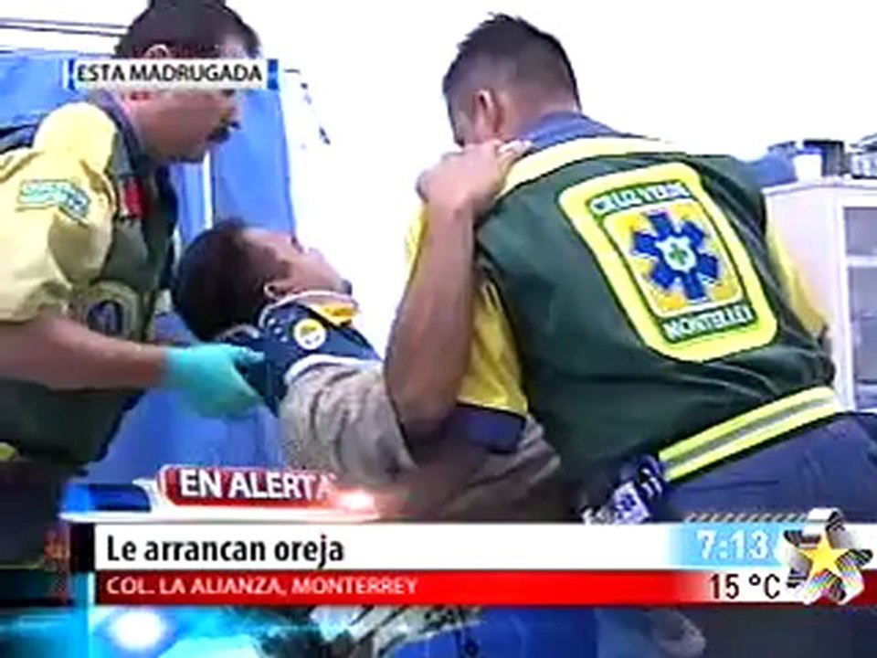 Le arrancan oreja (FUERTES IMAGENES)