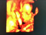 Sono Care of East Texas-3D & 4D Ultrasound Service