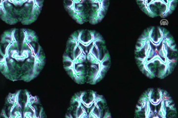 Epilepsinin etkileri, kadın ve erkeklerde farklı