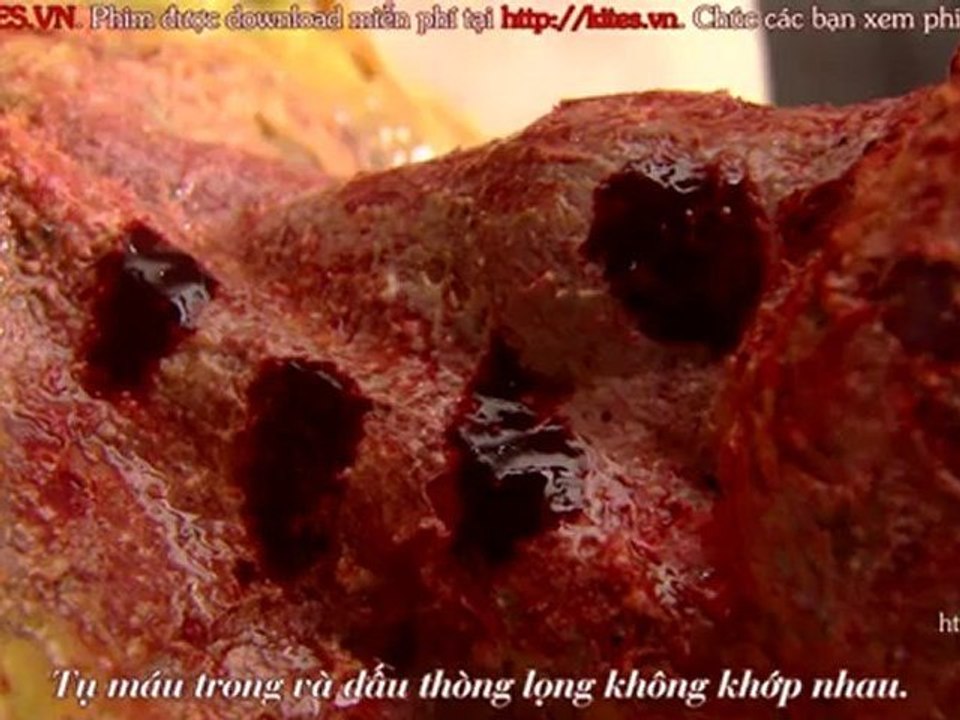 Bac si Bull Ep11 End [kites.vn]