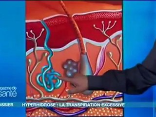 Stop à la Transpiration