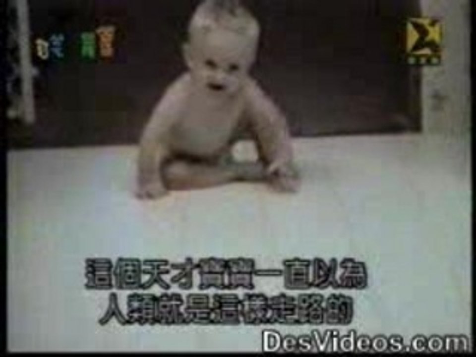 enfant grosse tete