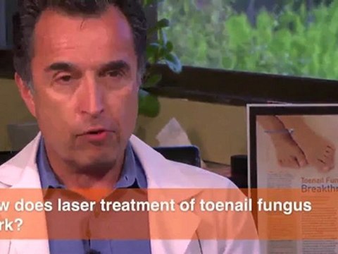 How does laser treatment of toenail fungus work?