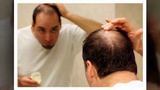 Natural Hair loss treatment for men - Provillus Reviews