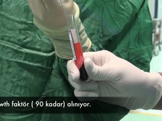 Hücre Kokteyli - Prof Dr Ahmet Karacalar - www.ahmetkaracalar.com