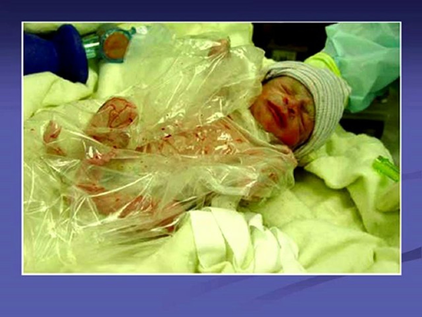 Neonatal Physiology