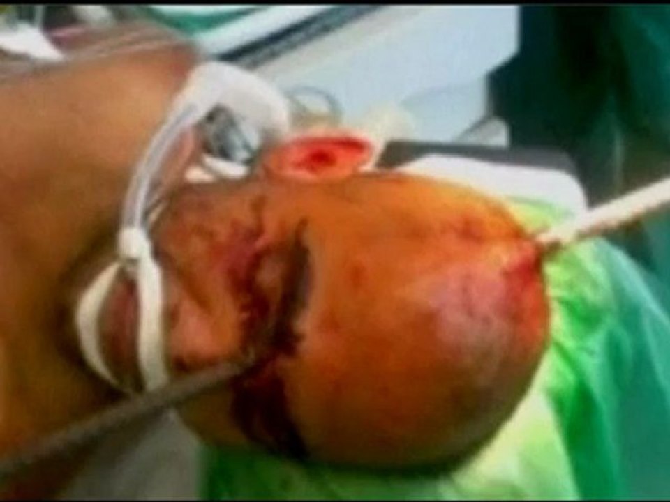 Construction Worker in Brazil Survives 6 Foot P...