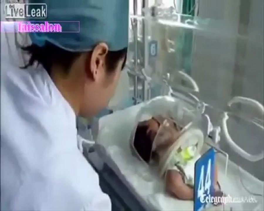enfant a deux têtes en chine incroyable naissance