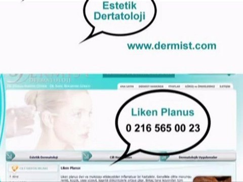 Liken Planus / dermist.com