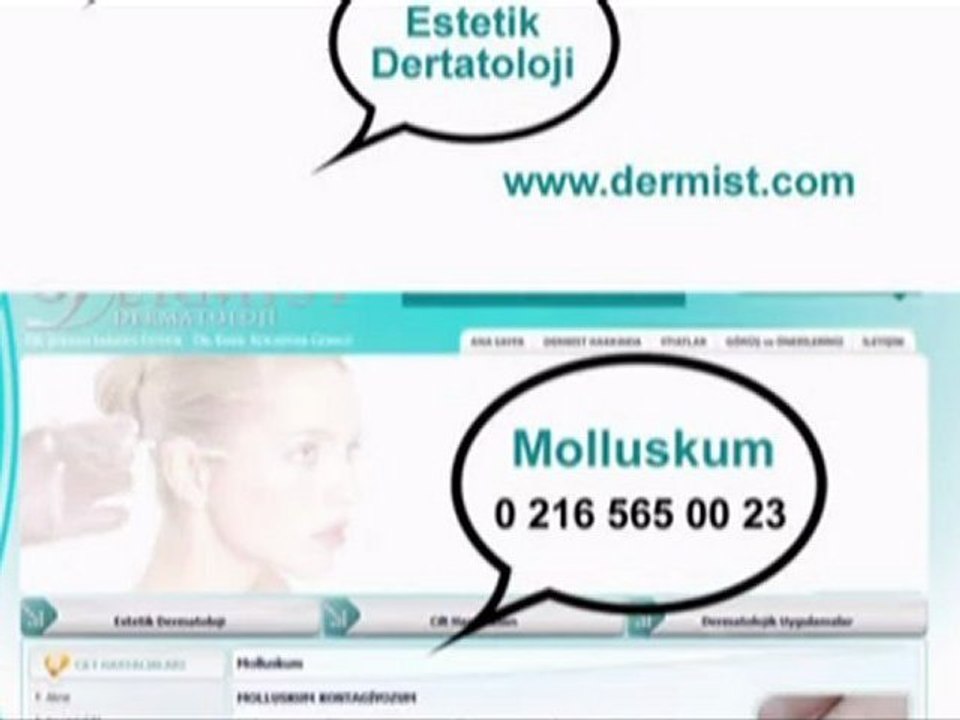 Molluskum / www.dermist.com