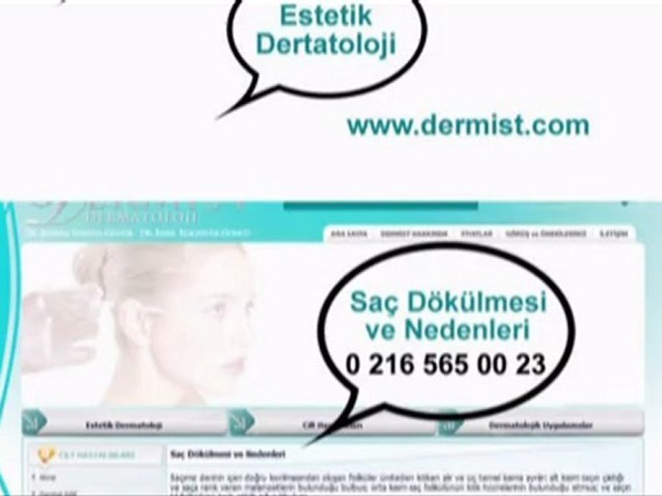 Saç Dökülmesi / www.dermist.com