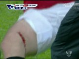 Wayne Rooney Injury