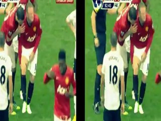 Wayne Rooney Horrible injury((.mpg