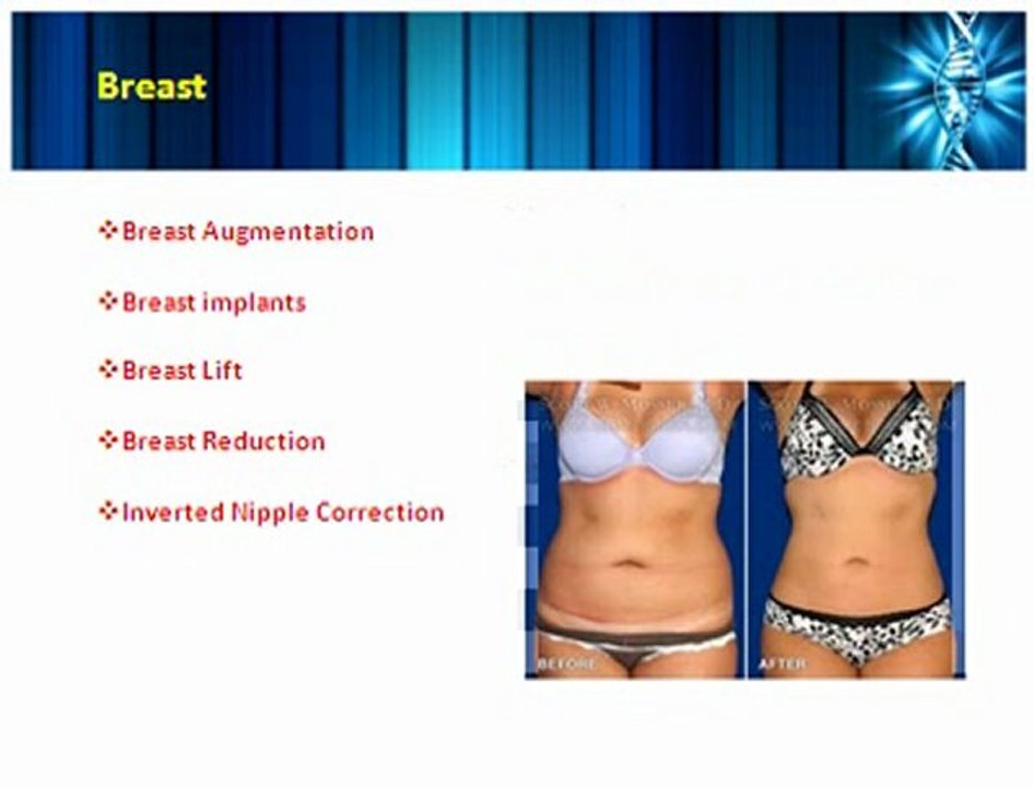 Plastic Surgery Consultation - Make an Informed Decision