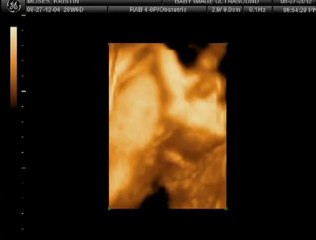 3D Ultrasound, Elizabeth Grace Moses #1