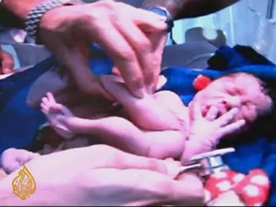 US invasion leaves lasting Iraq scars