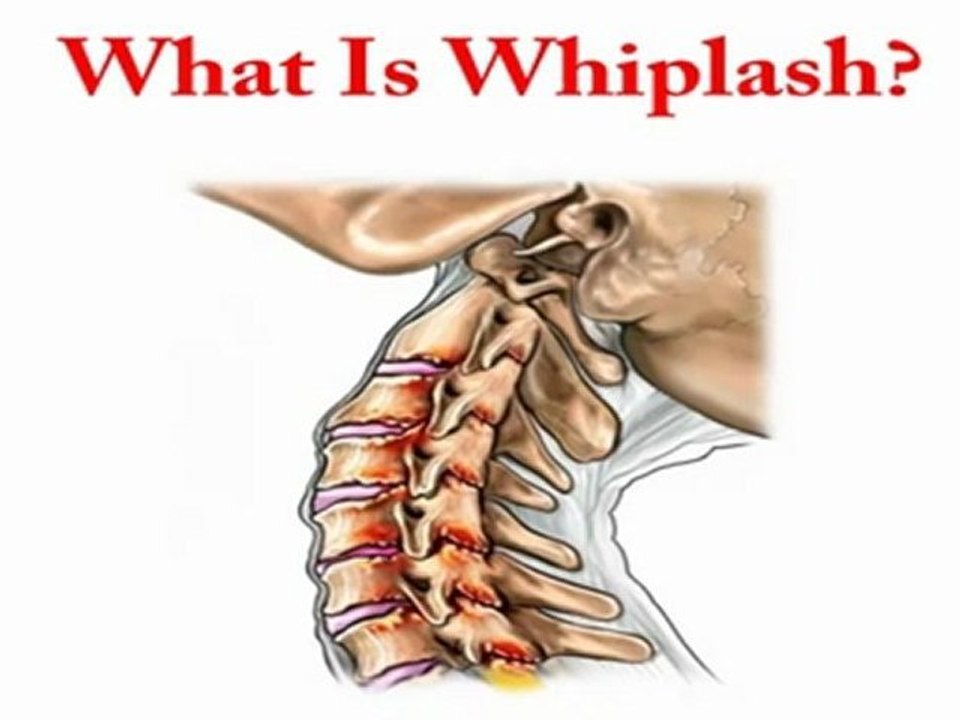 Orlando Personal Injury Doctors