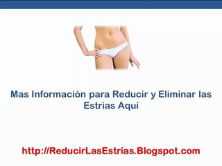Como Quitarme Las Estrias - remedio contra las estrias