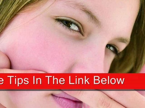 how to get rid of acne fast overnight,