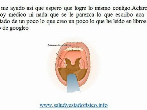 como eliminar las piedras en las amigdalas 2