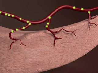 Le diabète, maladie du XXIè siècle