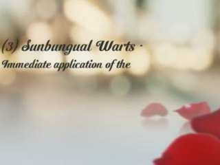 Learn and Discover The Best Of Wartrol Efficiency When It Comes To Wart Treatment