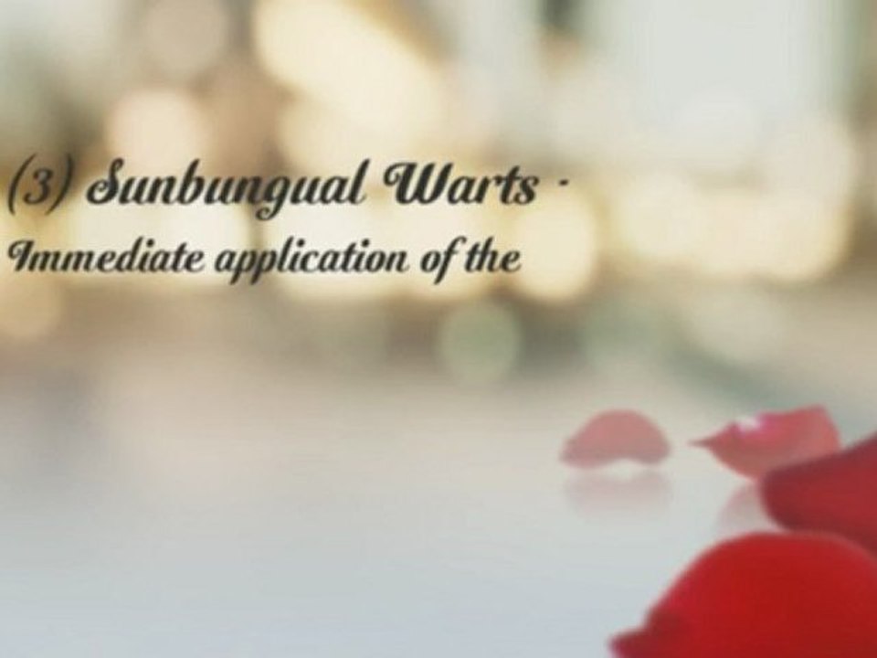Learn and Discover The Best Of Wartrol Efficiency When It Comes To Wart Treatment