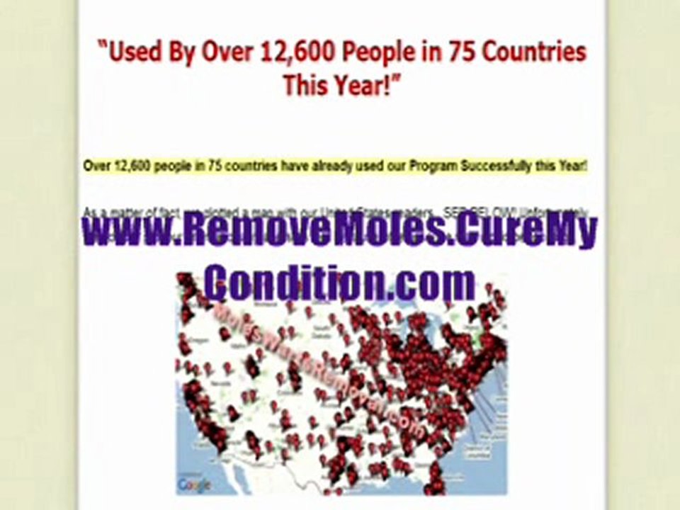 How To Remove Warts, Skin Tags And Moles By Yourself - Follow These Step By Step Instructions At Home