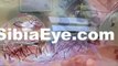 Eye Care Delray Beach, Delray Beach Eye Care, Delray Eye Care, Eye Exams Delray Beach, Delray Beach Eye Exams