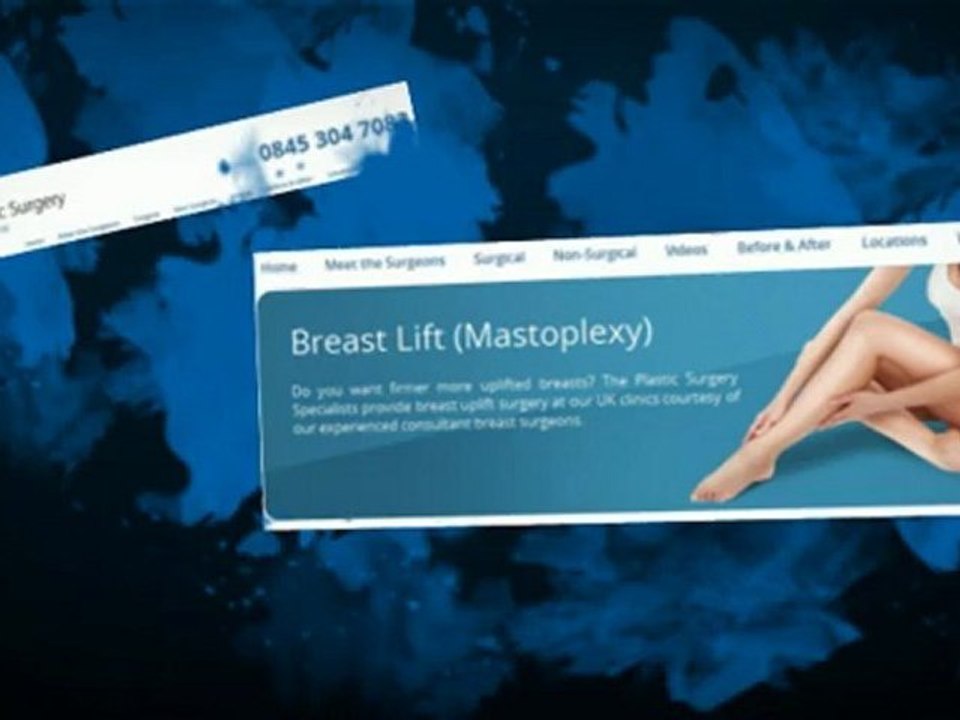 laser hair removal