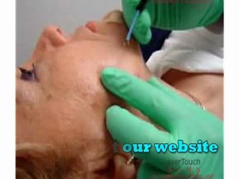 how to get rid of skin tags